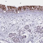 Atlas Antibodies Anti-VWC2 Antibody