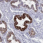 Atlas Antibodies Anti-VWDE Antibody