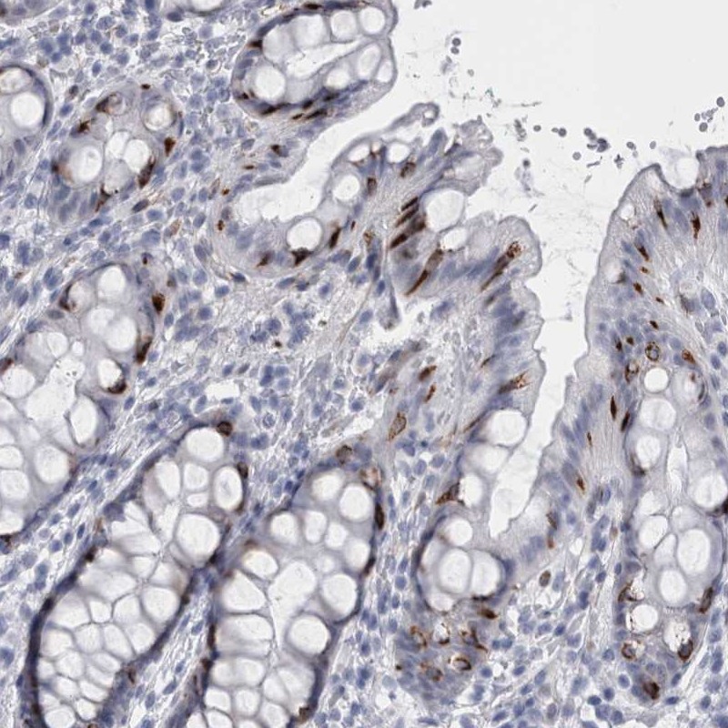 Atlas Antibodies Anti-VWDE Antibody