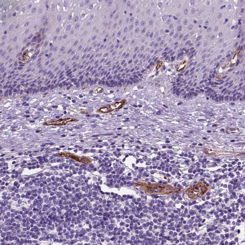 Atlas Antibodies Anti-VWF Antibody