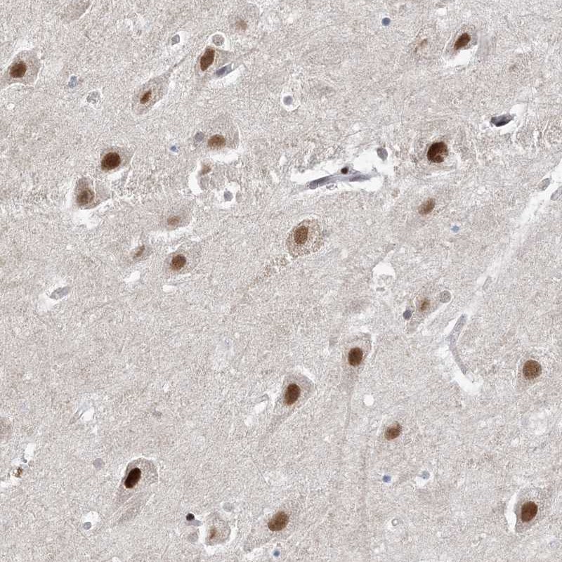 Atlas Antibodies Anti-WAC Antibody