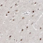 Atlas Antibodies Anti-WAC Antibody