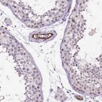 Atlas Antibodies Anti-VWF Antibody