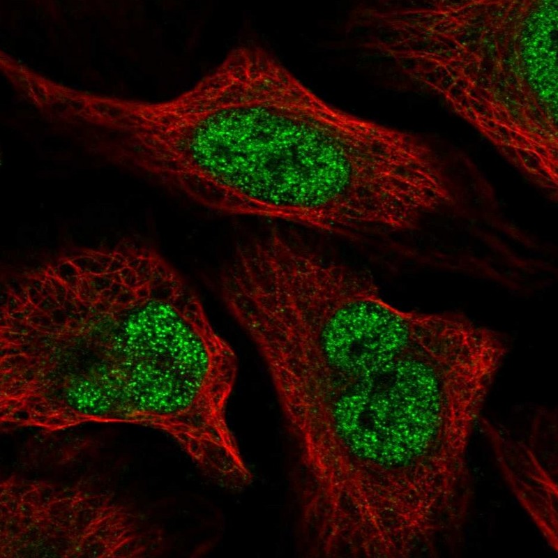 Atlas Antibodies Anti-WAC Antibody