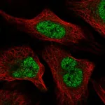 Atlas Antibodies Anti-WAC Antibody