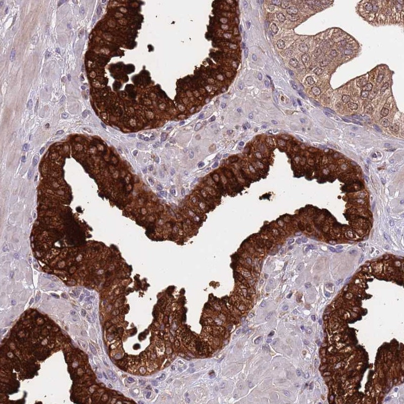 Atlas Antibodies Anti-VWCE Antibody