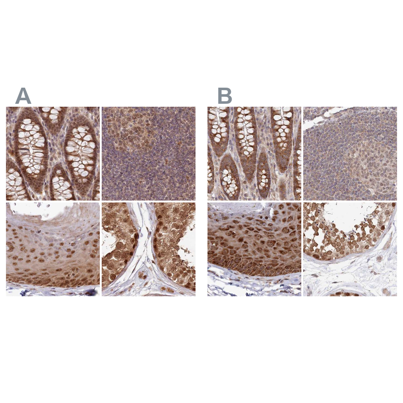 Atlas Antibodies Anti-WAPL Antibody