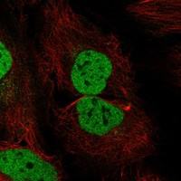 Atlas Antibodies Anti-WAPL Antibody