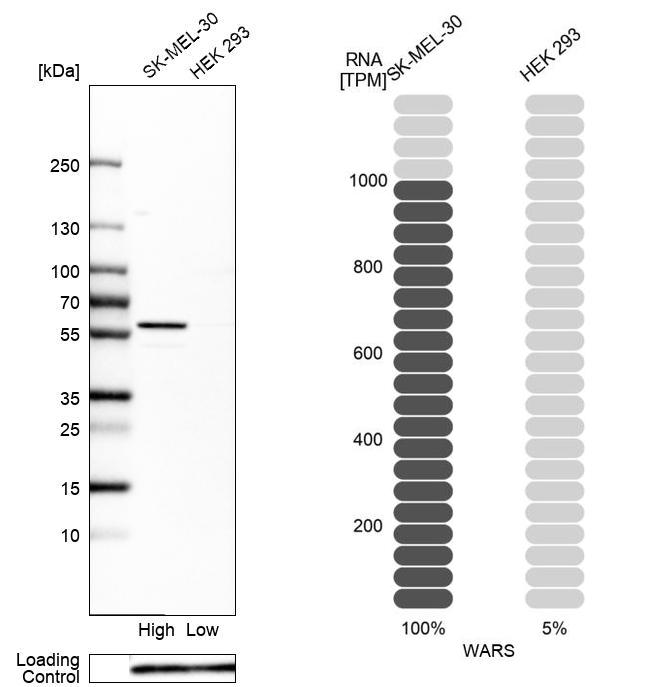 Atlas Antibodies Anti-WARS Antibody