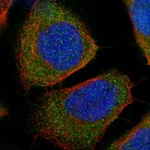 Atlas Antibodies Anti-WARS Antibody