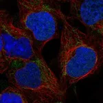 Atlas Antibodies Anti-WARS2 Antibody