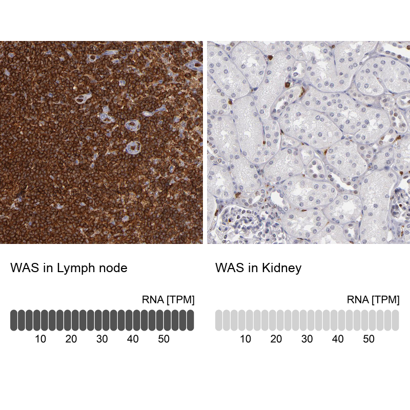 Atlas Antibodies Anti-WAS Antibody