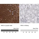 Atlas Antibodies Anti-WAS Antibody