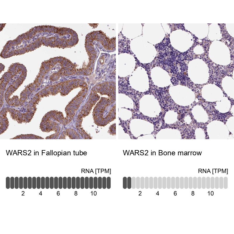 Atlas Antibodies Anti-WARS2 Antibody