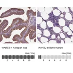 Atlas Antibodies Anti-WARS2 Antibody