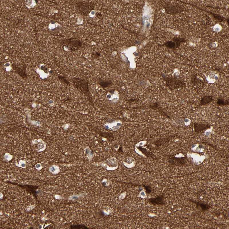 Atlas Antibodies Anti-WASF1 Antibody