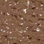 Atlas Antibodies Anti-WASF1 Antibody