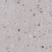 Atlas Antibodies Anti-WASF3 Antibody