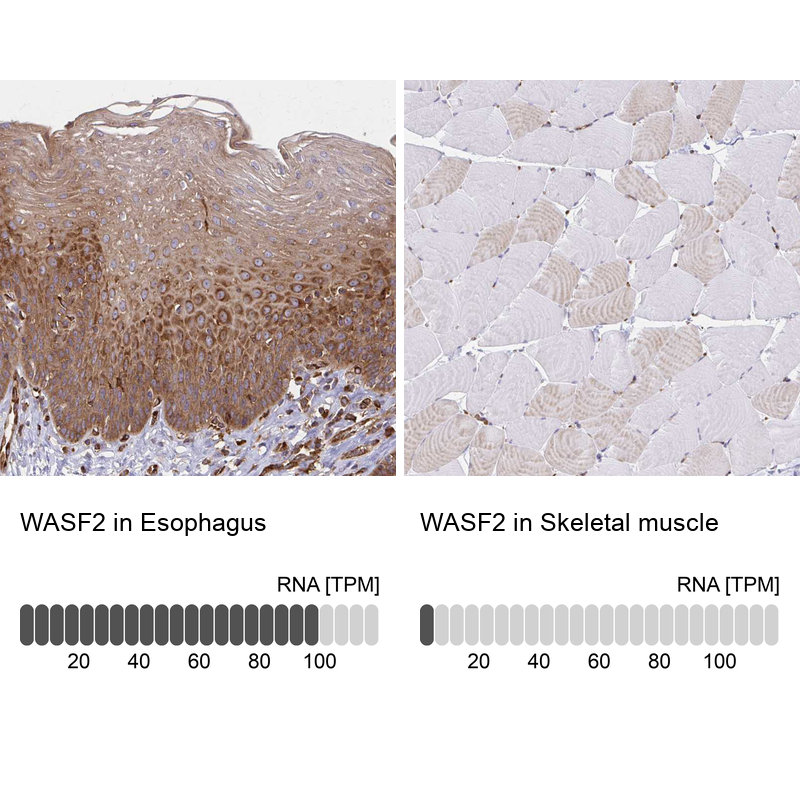 Atlas Antibodies Anti-WASF2 Antibody