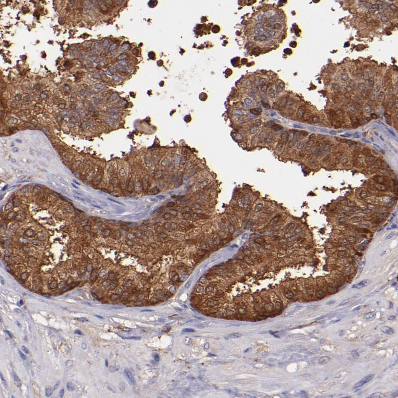Atlas Antibodies Anti-WASHC1 Antibody