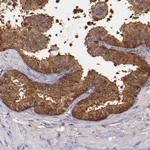 Atlas Antibodies Anti-WASHC1 Antibody