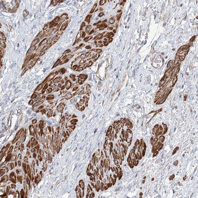 Atlas Antibodies Anti-WASHC3 Antibody