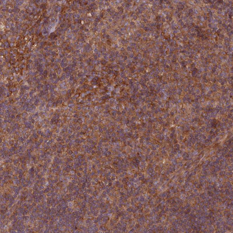 Atlas Antibodies Anti-WASHC2A Antibody