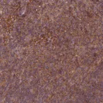 Atlas Antibodies Anti-WASHC2A Antibody
