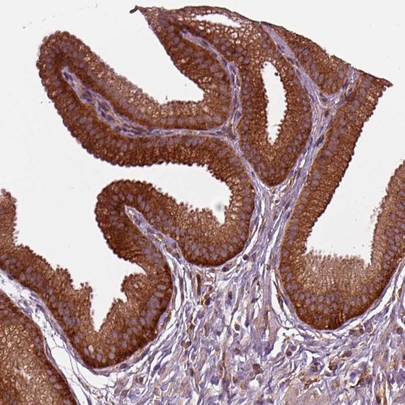 Atlas Antibodies Anti-WASHC2A Antibody