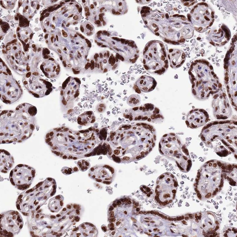 Atlas Antibodies Anti-WASHC4 Antibody