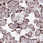 Atlas Antibodies Anti-WASHC4 Antibody