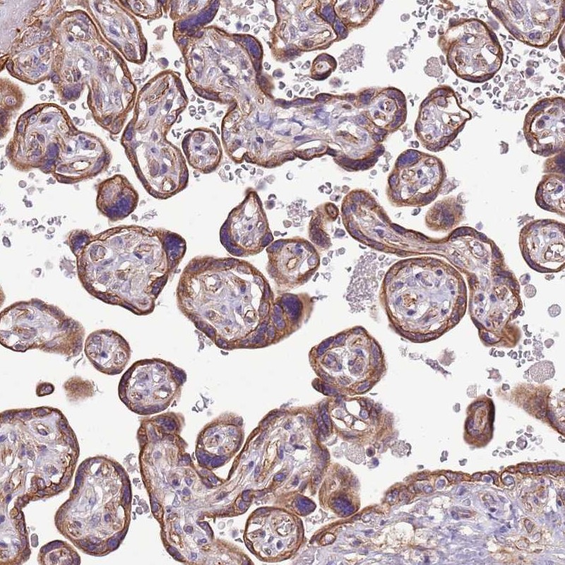 Atlas Antibodies Anti-WASHC4 Antibody