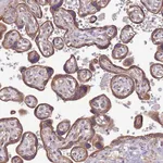 Atlas Antibodies Anti-WASHC4 Antibody