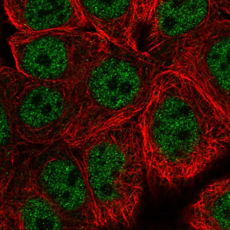Atlas Antibodies Anti-WASHC5 Antibody