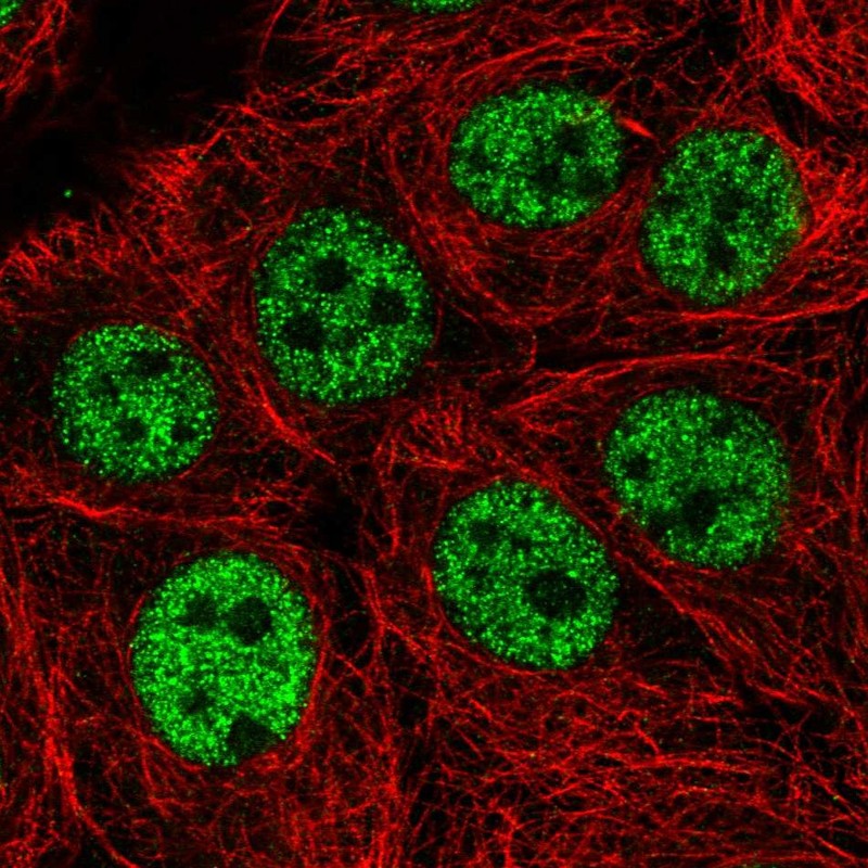Atlas Antibodies Anti-WASHC5 Antibody