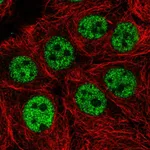 Atlas Antibodies Anti-WASHC5 Antibody