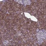 Atlas Antibodies Anti-WBP1 Antibody