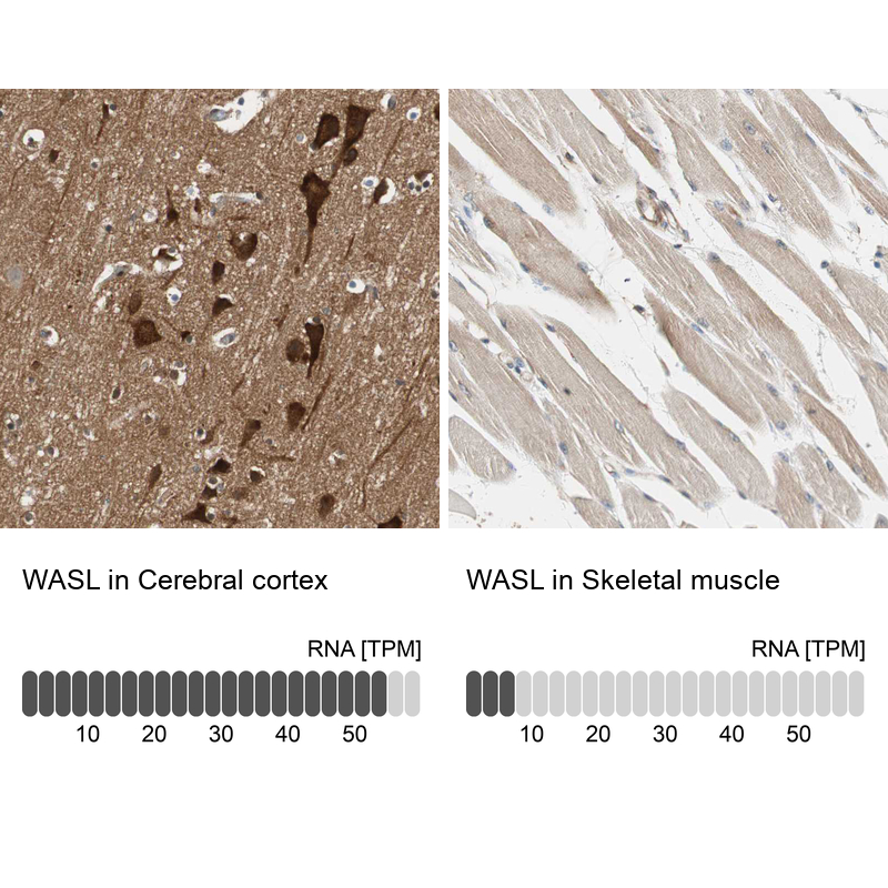 Atlas Antibodies Anti-WASL Antibody