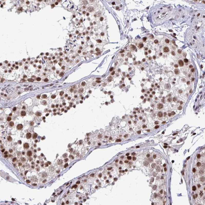Atlas Antibodies Anti-WBP11 Antibody
