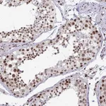 Atlas Antibodies Anti-WBP11 Antibody