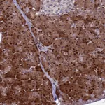 Atlas Antibodies Anti-WBP11 Antibody