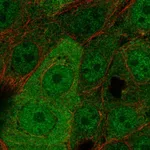 Atlas Antibodies Anti-WBP2 Antibody