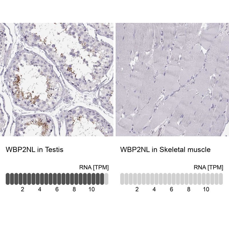 Atlas Antibodies Anti-WBP2NL Antibody