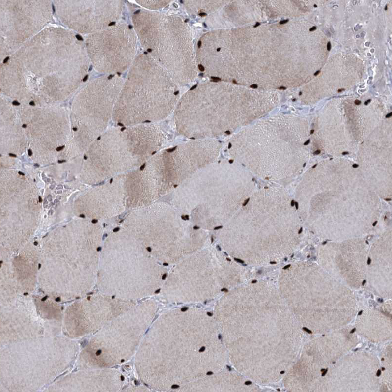 Atlas Antibodies Anti-WBP4 Antibody