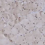 Atlas Antibodies Anti-WBP4 Antibody