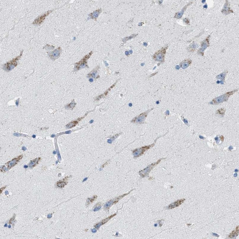 Atlas Antibodies Anti-WBSCR17 Antibody