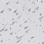 Atlas Antibodies Anti-WBSCR17 Antibody