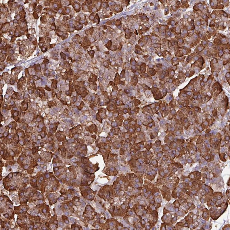 Atlas Antibodies Anti-WBSCR22 Antibody