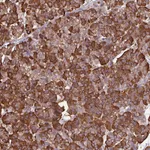 Atlas Antibodies Anti-WBSCR22 Antibody