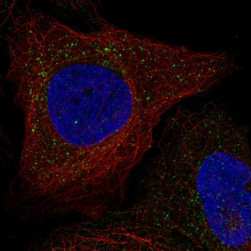 Atlas Antibodies Anti-WBSCR28 Antibody